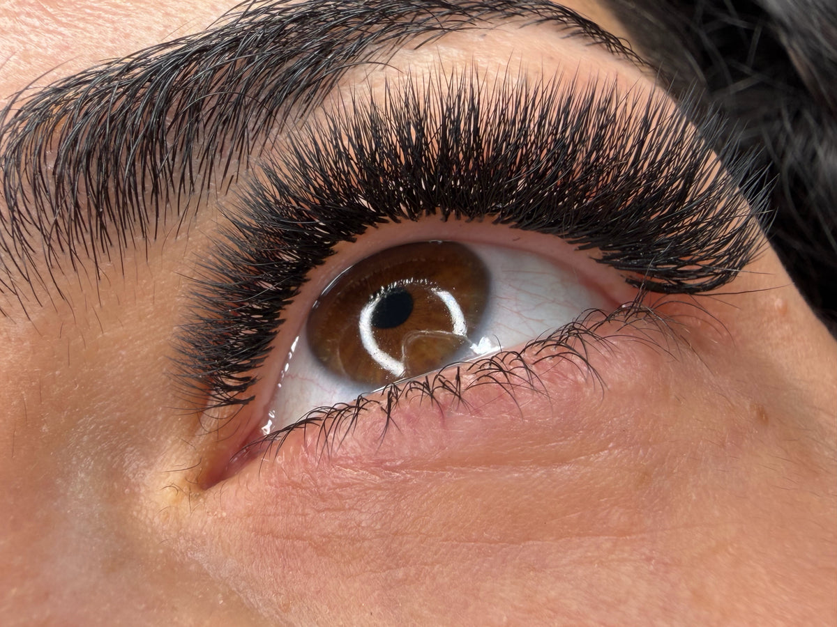 Refill 4D-6D Volumen innerhalb 28 Tage